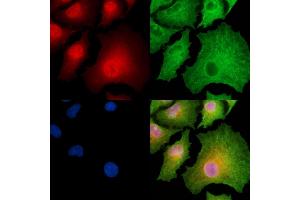 ABIN6262437 and ABIN6278874 staining  cells by IF/ICC. (CARD18 antibody  (C-Term))