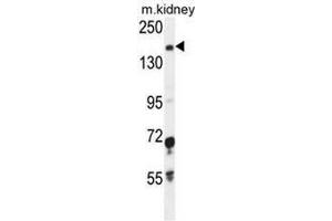IGSF1 Antibody (C-term) western blot analysis in mouse kidney tissue lysates (35µg/lane). (IGSF1 antibody  (C-Term))