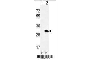 Western blot analysis of HRAS using rabbit polyclonal HRAS Antibody using 293 cell lysates (2 ug/lane) either nontransfected (Lane 1) or transiently transfected (Lane 2) with the HRAS gene.