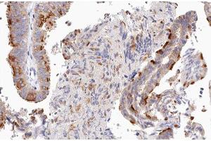 ABIN6266898 at 1/100 staining human Fallopian tube tissue sections by IHC-P.
