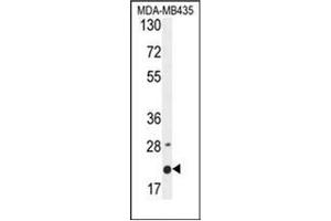 Western blot analysis of MS4A4A Antibody (N-term) in MDA-MB435 cell line lysates (35ug/lane). (MS4A4A antibody  (N-Term))