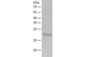 Western Blotting (WB) image for N-6 Adenine-Specific DNA Methyltransferase 1 (Putative) (N6AMT1) (AA 1-214) protein (His tag) (ABIN7289564) (N6AMT1 Protein (AA 1-214) (His tag))