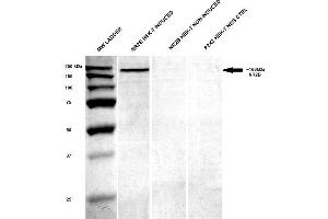 GRIN2B antibody  (AA 20-271) (FITC)