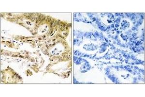 Immunohistochemistry (IHC) image for anti-Mediator Complex Subunit 23 (MED23) (AA 1-50) antibody (ABIN2889807) (MED23 antibody  (AA 1-50))