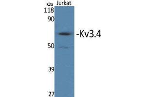 Western Blot (WB) analysis of specific cells using Kv3. (Kv3.4 antibody  (Ser676))