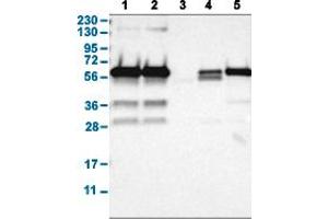 Western Blot analysis with HDAC2 polyclonal antibody . (HDAC2 antibody  (AA 415-488))