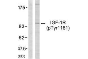 Western blot analysis of extracts from 293 cells treated with Insulin, using IGF1R (Phospho-Tyr1161) Antibody.