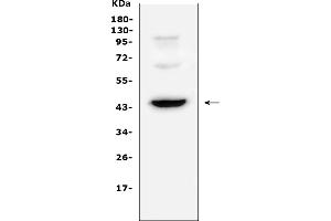 Western blot analysis of CD72 using anti-CD72 antibody (ABIN6719589).