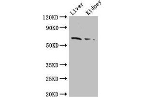 Western Blot Positive WB detected in: Mouse liver tissue, Mouse kidney tissue All lanes: FZD9 antibody at 2.