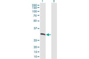 Western Blot analysis of MCART1 expression in transfected 293T cell line by MCART1 MaxPab polyclonal antibody. (MCART1 antibody  (AA 1-297))