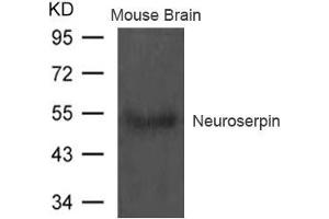 Western blot analysis of extract from Mouse brain tissue using Neuroserpin Antibody (Neuroserpin antibody)