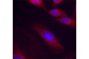 Immunofluorescence staining of methanol-fixed Hela cells using Phospho-RELA-S536 antibody. (NF-kB p65 antibody  (pSer536))