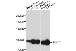 Western blot analysis of extracts of various cell lines, using SCYL2 antibody.