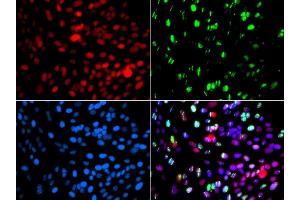 Immunofluorescence analysis of GFP-RNF168 transgenic U2OS cells using POLD3 antibody. (POLD3 antibody  (AA 197-466))