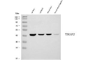 anti-Transmembrane 6 Superfamily Member 2 (TM6SF2) (AA 78-377) antibody