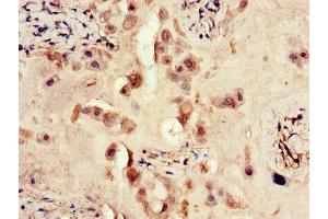 Immunohistochemistry of paraffin-embedded human placenta tissue using ABIN7167466 at dilution of 1:100 (ERBB4 antibody  (AA 1027-1204))