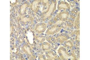 Immunohistochemistry of paraffin-embedded Rat kidney using Myelin Basic protein Polyclonal Antibody at dilution of 1:200 (40x lens). (MBP antibody)