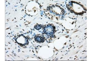 Immunohistochemical staining of paraffin-embedded prostate tissue using anti-ERCC1 mouse monoclonal antibody. (ERCC1 antibody)