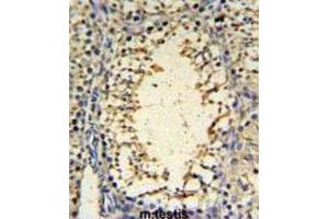 Immunohistochemistry (IHC) image for anti-IMP3, U3 Small Nucleolar Ribonucleoprotein (IMP3) antibody (ABIN3004369) (IMP3 antibody)