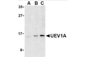 Image no. 1 for anti-Ubiquitin-Conjugating Enzyme E2 Variant 1 (UBE2V1) (C-Term) antibody (ABIN265158) (UBE2V1 antibody  (C-Term))