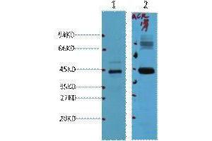 Western Blotting (WB) image for anti-alpha-Methylacyl-CoA Racemase (AMACR) antibody (ABIN3181117)