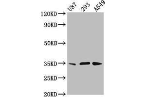 Western Blot Positive WB detected in: U87 whole cell lysate, 293 whole cell lysate, A549 whole cell lysate All lanes: VAX1 antibody at 3. (VAX1 antibody  (AA 2-106))