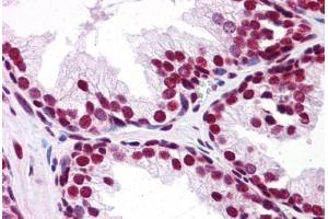 Human Prostate: Formalin-Fixed, Paraffin-Embedded (FFPE) (UBA2 antibody  (C-Term))