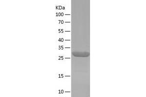 Western Blotting (WB) image for Aldo-Keto Reductase Family 1, Member A1 (Aldehyde Reductase) (AKR1A1) (AA 1-325) protein (His tag) (ABIN7285403) (AKR1A1 Protein (AA 1-325) (His tag))