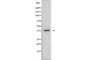 Western blot analysis of extracts from MCF-7 cells, using ABHD9 antibody. (ABHD9 antibody  (N-Term))