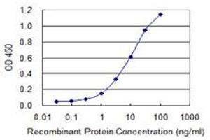 Detection limit for recombinant GST tagged IRX6 is 0. (IRX6 antibody  (AA 337-446))