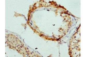 Immunohistochemistry of paraffin-embedded human testis tissue using ABIN7144362 at dilution of 1:100 (AP2A2 antibody  (AA 590-939))