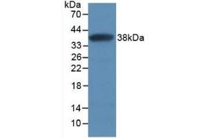 Detection of Recombinant SFRP1, Human using Monoclonal Antibody to Secreted Frizzled Related Protein 1 (SFRP1) (SFRP1 antibody  (AA 32-314))