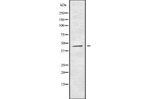 Western blot analysis of HOXB3 using K562 whole cell lysates (HOXB3 antibody  (C-Term))