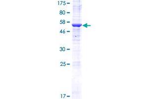 HRAS-Like Suppressor Family, Member 5 (HRASLS5) (AA 1-269) protein (GST tag)