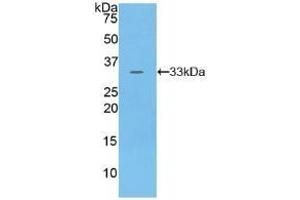 Detection of Recombinant PKN1, Human using Polyclonal Antibody to Protein Kinase N1 (PKN1) (PKN1 antibody  (AA 615-874))