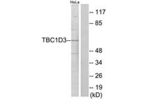 Western blot analysis of extracts from HeLa cells, using TBC1D3 Antibody. (TBC1D3 antibody  (AA 481-530))