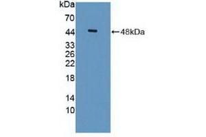Detection of Recombinant ISLR, Human using Polyclonal Antibody to Immunoglobulin Superfamily Containing Leucine Rich Repeat Protein (ISLR) (ISLR antibody  (AA 19-428))