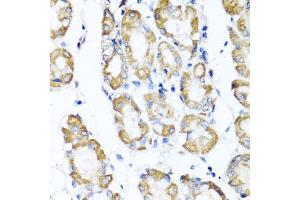 Immunohistochemistry of paraffin-embedded human stomach using ST6GAL1 antibody (ABIN5973377) at dilution of 1/100 (40x lens). (ST6GAL1 antibody)