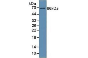 Detection of GAS6 in Human Liver Tissue using Polyclonal Antibody to Growth Arrest Specific Protein 6 (GAS6) (GAS6 antibody  (AA 136-311))