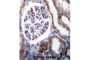 IFT88 Antibody (C-term) immunohistochemistry analysis in formalin fixed and paraffin embedded human kidney tissue followed by peroxidase conjugation of the secondary antibody and DAB staining. (IFT88 antibody  (C-Term))