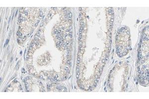 ABIN6267562 at 1/100 staining Human prostate tissue by IHC-P. (Calmodulin 1 antibody  (pSer81, pThr79))