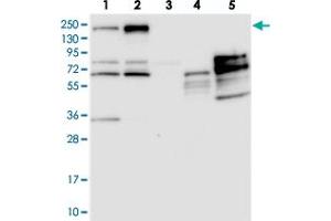 Western blot analysis of Lane 1: RT-4, Lane 2: U-251 MG, Lane 3: Human Plasma, Lane 4: Liver, Lane 5: Tonsil with PDS5B polyclonal antibody  at 1:250-1:500 dilution. (PDS5B antibody)
