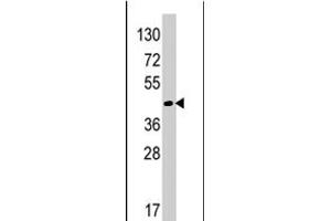 Western blot analysis of RAD9A polyclonal antibody  in HeLa cell line lysates (35 ug/lane). (RAD9A antibody  (Internal Region))