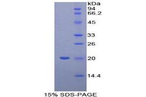 SDS-PAGE (SDS) image for Cyclophilin B (PPIB) (AA 47-216) protein (His tag) (ABIN1878451)