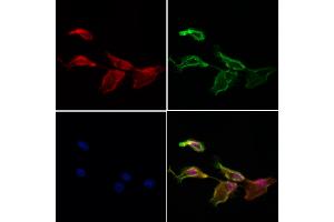ABIN7094098 and ABIN7098142 staining Hela cells by IF/ICC. (C14orf102 antibody  (Internal Region))