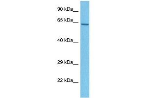 Host:  Rabbit  Target Name:  MBOAT1  Sample Tissue:  Human U937 Whole Cell  Antibody Dilution:  1ug/ml (MBOAT1 antibody  (N-Term))