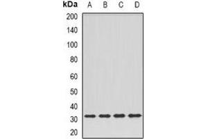 Western blot analysis of DPM1 expression in Hela (A), SKOV3 (B), mouse kidney (C), rat liver (D) whole cell lysates. (DPM1 antibody)