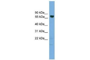 Western Blot showing GCLC antibody used at a concentration of 1-2 ug/ml to detect its target protein. (GCLC antibody  (Middle Region))