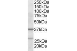 ABIN184750 staining (2µg/ml) of Human Liver lysate (RIPA buffer, 35µg total protein per lane). (ARPC1B antibody  (N-Term))