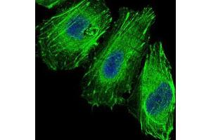 Immunofluorescence analysis of Hela cells using FOXO1 mouse mAb (green). (FOXO1 antibody)